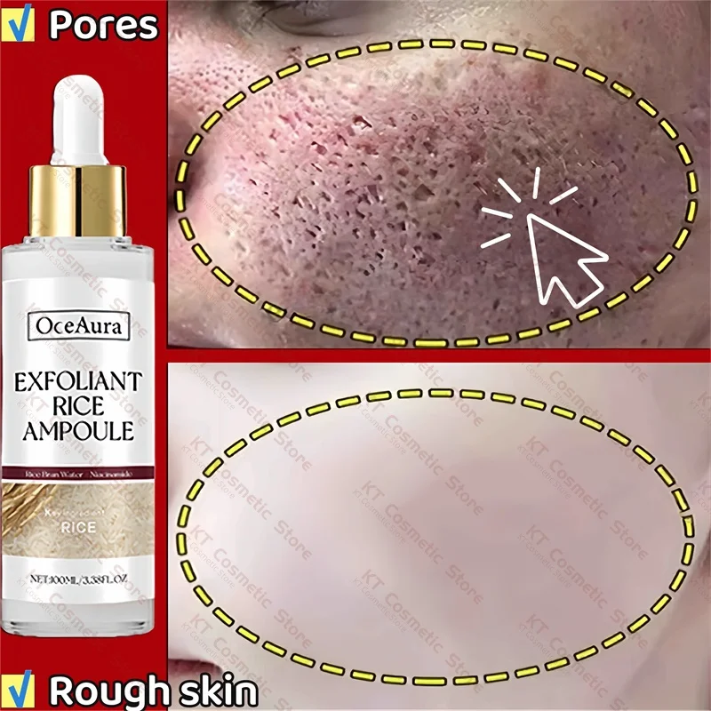 

White Rice Exfoliating Serum Remove Large Pores Oil Control Deep Cleaning Blackhead Brighten Moisturize Rough Dull Face Skincare