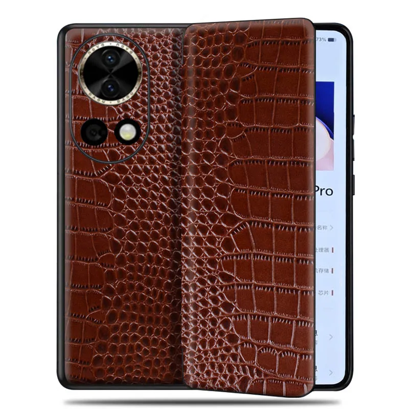 

Wobiloo Luxury Genuine Leather Wallet Cover Business Phone Cases For Huawei Nova 12 Nova12 Pro Ultra Cover Credit Slot Case