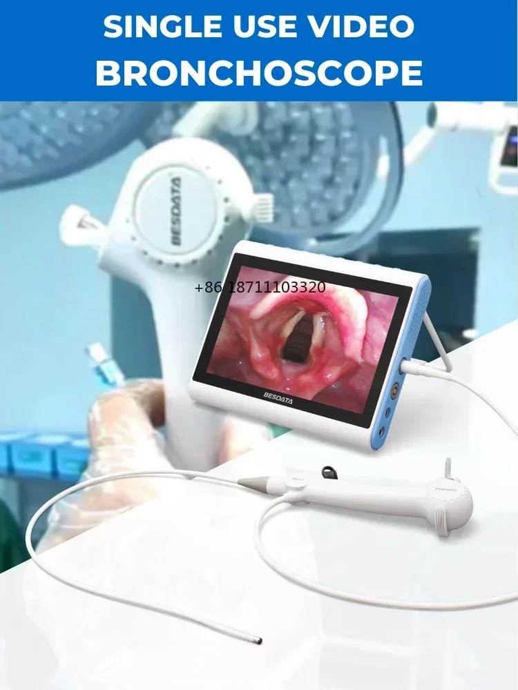 Bronchoscopy Ent Endoscope System ENT Endoscopy Flexible Laryngoscope Bronchoscopy Cystoscopy Nasopharyngoscope for Surgical