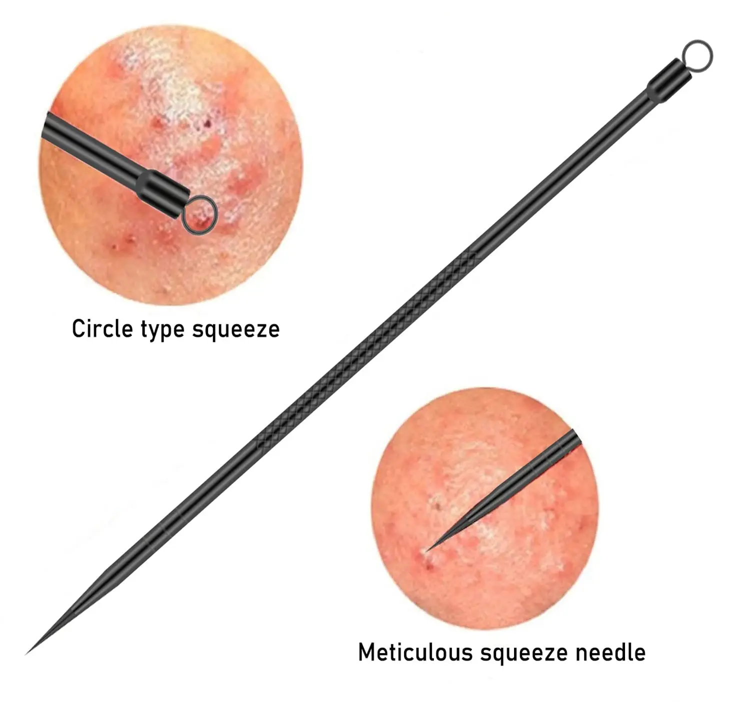 Ensemble d'aiguilles professionnelles pour points noirs du visage, extracteur de points blancs d'acné en acier inoxydable, outil de nettoyage en profondeur du visage, 4
