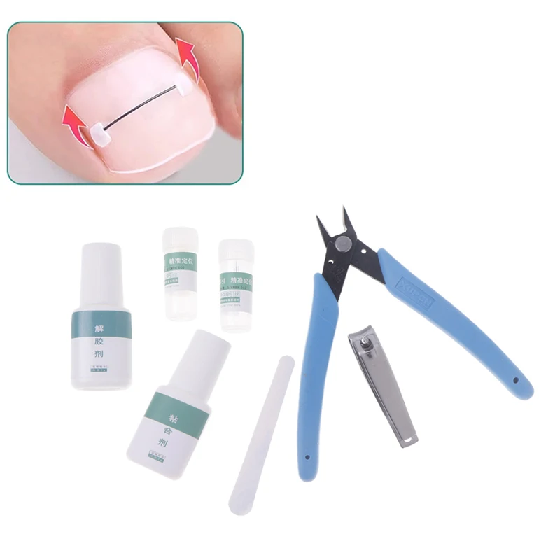 Ingrown Toenail Corrector Tools Pedicure Recover Embed Toenail Treatment Professional Ingrown Toenail Correction Foot Care Tool