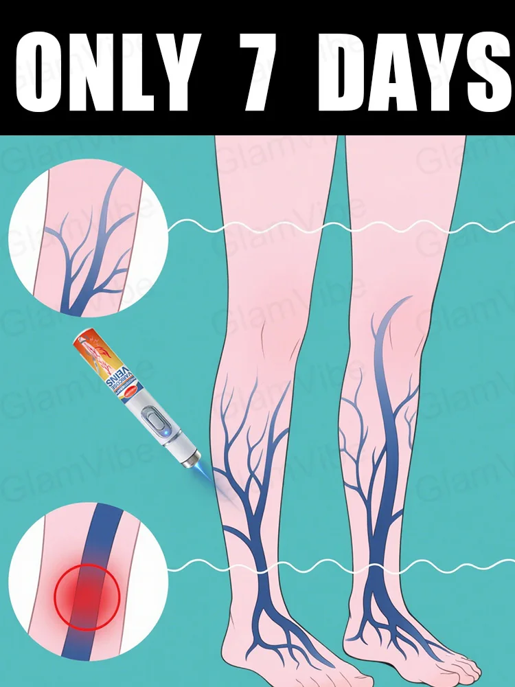 

Generation-2 Laser Says Goodbye To Spider Legs Varicose In 7 Days