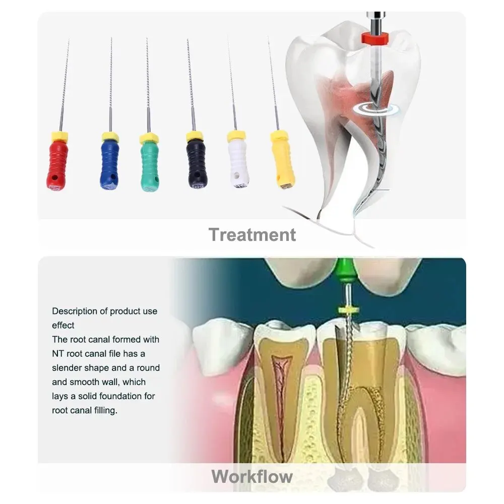 6 sztuk/paczka 21mm/25mm ręczne dentystyczne rozwiertaki NITI Denspay bardziej miękki i elastyczny dostęp endodontyczny pilniki R instrumenty