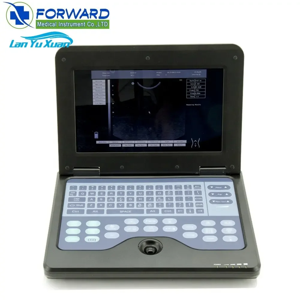 

Portable Laptop Style Medical 4D Ultrasound Scanning Machine for Hospitals