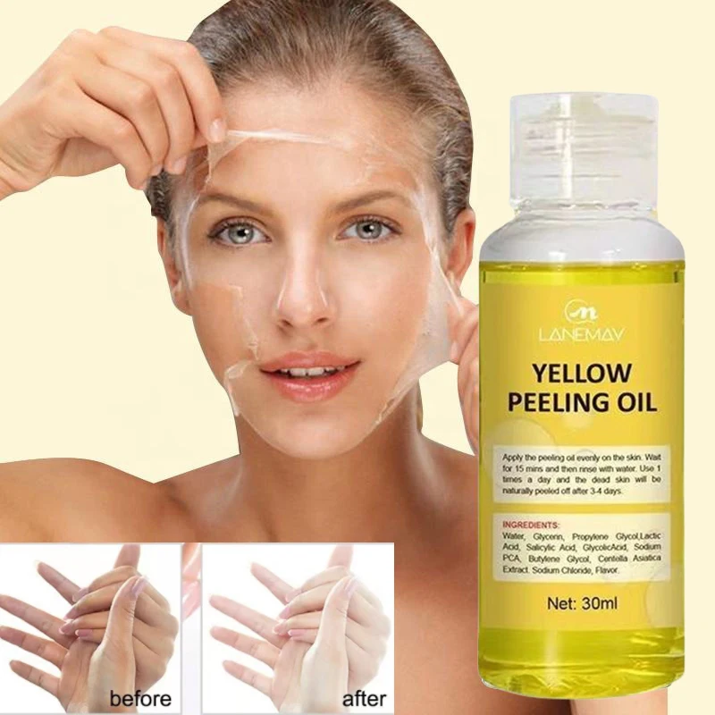 Yellow Peeling Oil For Dark Skin Bleaching Exfoliating For Face Lightening Body Peeling Dead Skin Removal Brighten Skin Tone30ML