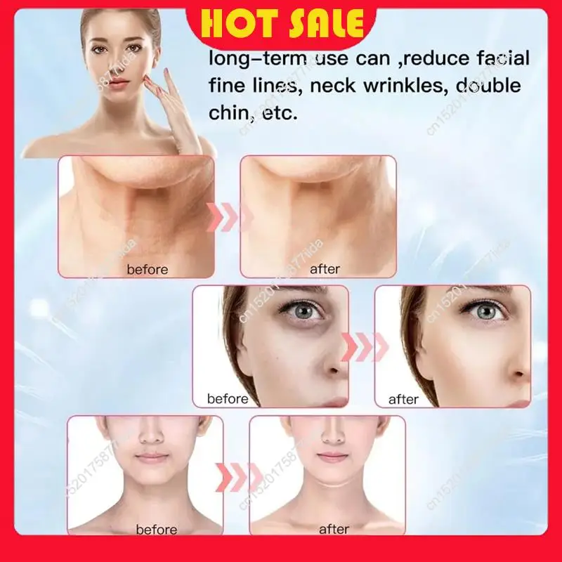 Hot Deal-Neck Beauty Cervical Massager Multi-Function Neck Massage Device Nasolabial Fold Removal Tool