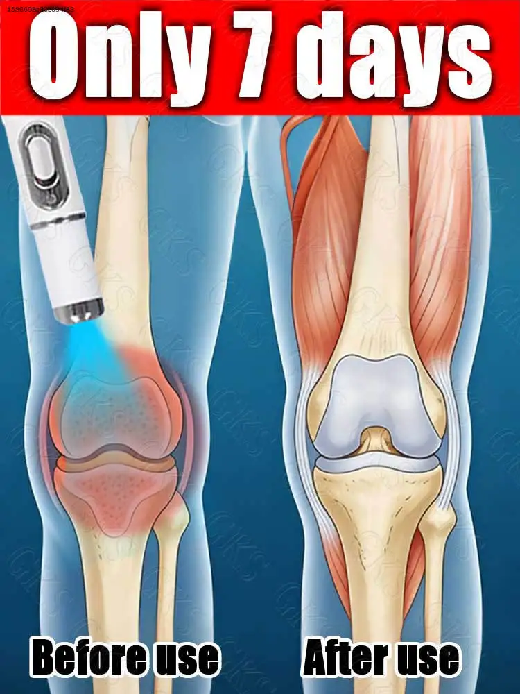 

Kɴᴇᴇ OsᴛᴇᴏᴀʀᴛʜʀɪᴛɪS / Kɴᴇᴇ DᴇɢᴇɴᴇʀᴀᴛɪᴏN