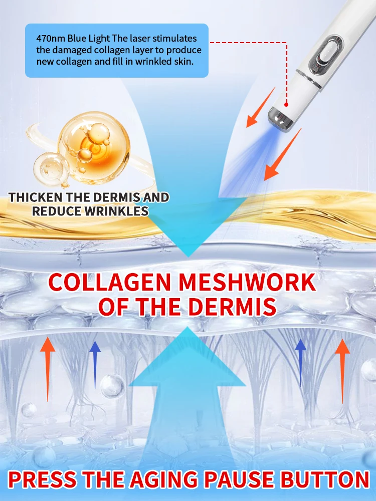 ลบริ้วรอยบนใบหน้าอย่างมีประสิทธิภาพและปรับปรุงความกระชับ