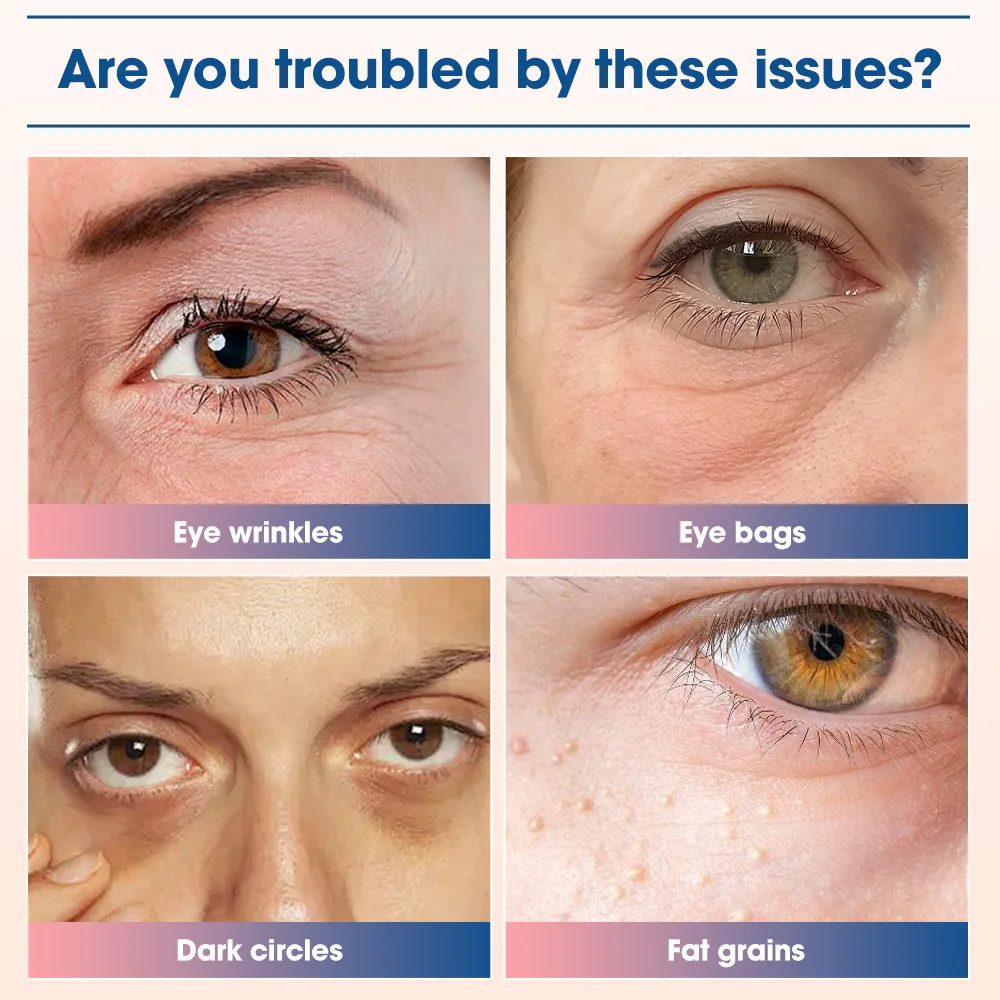 赤色光EMSアイマッサージャー、ジェルパッチ付き、クマ、むくみ、しわの軽減、疲労軽減のためのアイケアマッサージデバイス