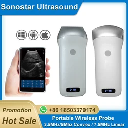 wireless ultrasound probe Wifi Probe Convex / Linear support ISO Andriod Portable wifi-scanner 3.5Hhz / 7.5Mhz