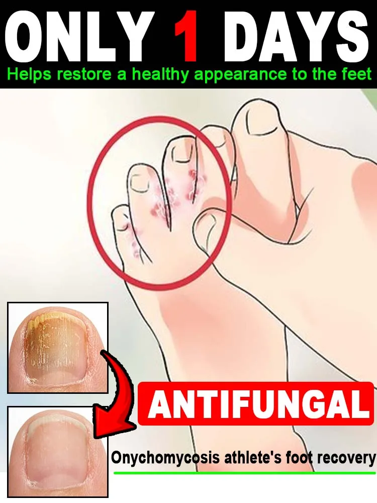 

Tʜᴇ ʜᴀʀsʜ ᴇɴᴠɪʀᴏɴᴍᴇɴᴛ ᴏғ ᴛʜᴇ ғᴇᴇᴛ! Tɪᴍᴇʟʏ ᴄᴀʀᴇ ɪs ᴄʀᴜᴄɪᴀʟ,Make every day easy