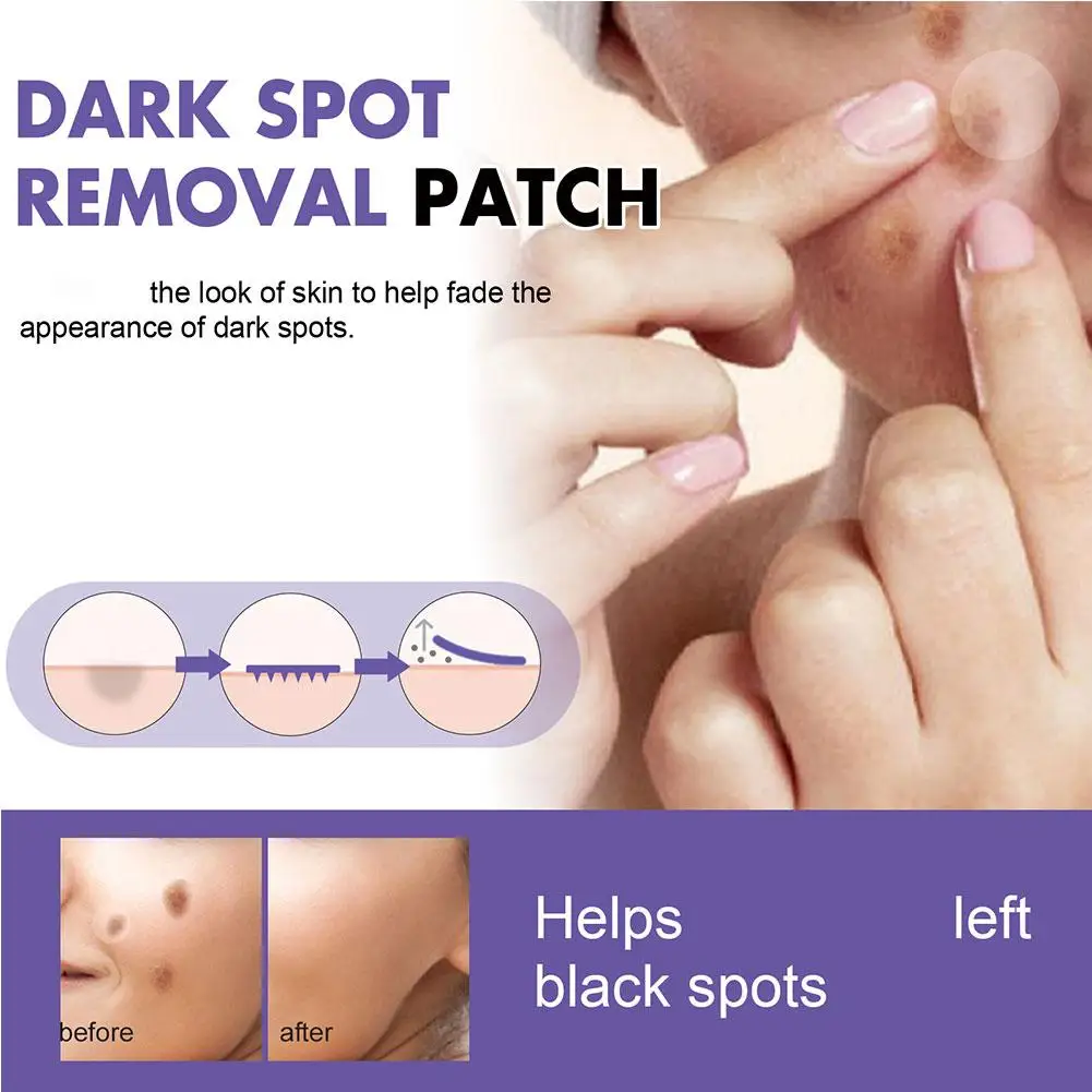Dark Spot Correcting Patches Freckles Remover Brightening Fade Dark Spots Lightening Melasma Facial Invisible Care Sticker - view 6