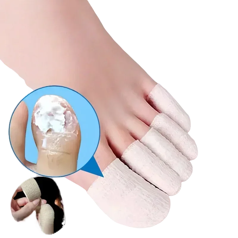 Toe protection, self-adhesive bandage, fungal nail polish, foot and finger protection, nail coating, toe and finger protection