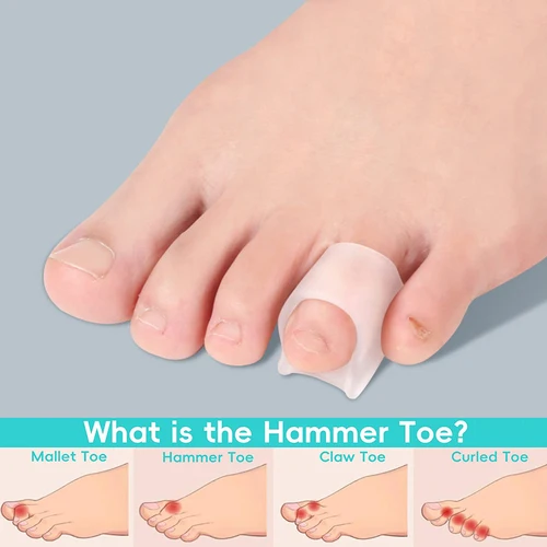 Imagen 2 del producto Pexmen, 2 uds., alisador de dedos en martillo, Corrector de punta en martillo para rizar, torcido, doblado y garra, punta superior para levantar el dedo del pie, calma el maíz superior