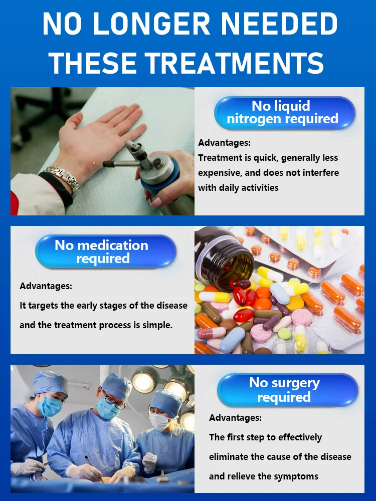 Technology changes life and Bestselling body tools, wart removal body tools, little blue bottle Free shipping,Unisex