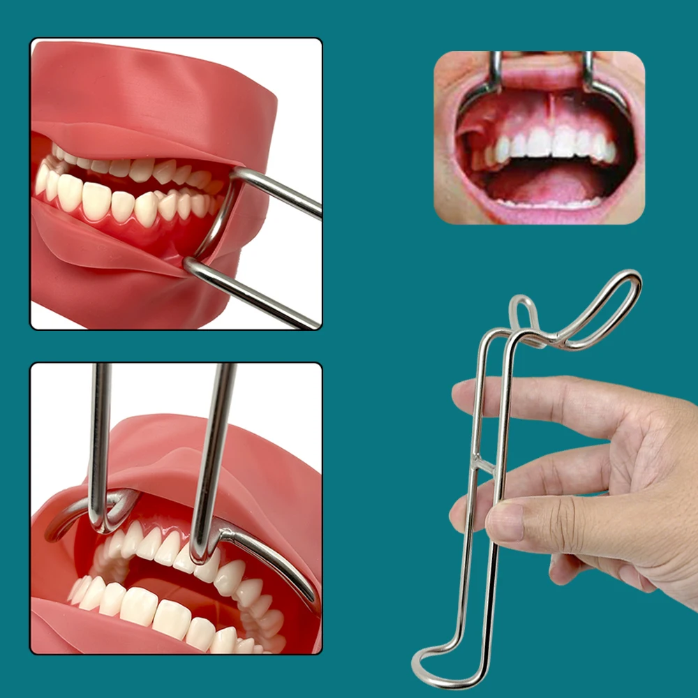 

Dental Mouth Retractor Double Headed Lip Cheek Retractor Stainless Steel for Intraoral Access Upper Lower Lip Separation
