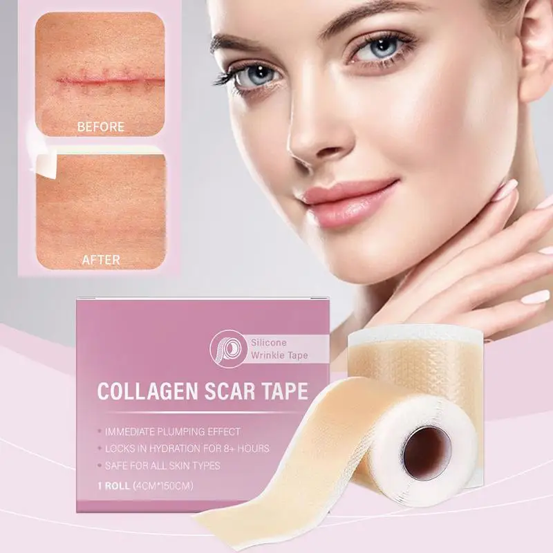 1 Roll Silicone Scar Sheets, 4cm X 150cm Self-Adhesive Scar Cover Tape Reusable and Effective Skin Care Strips Collagen Scar Tap image 6