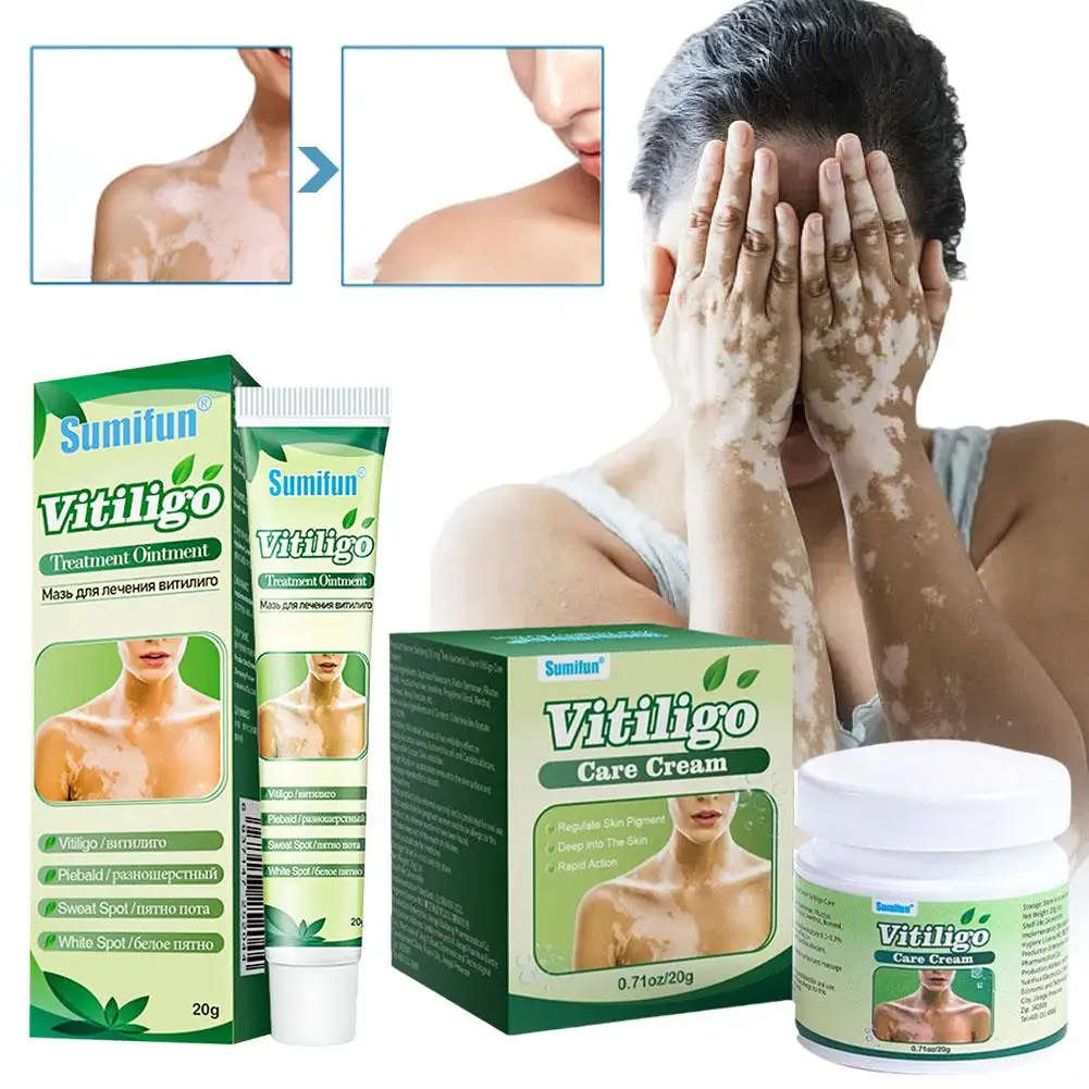 Vitiligo salep Herbal ekstrak, penghilang Ringworm putih Spot Vitiligo perawatan penghilang kulit Vitiligo krim menghilangkan C0P1