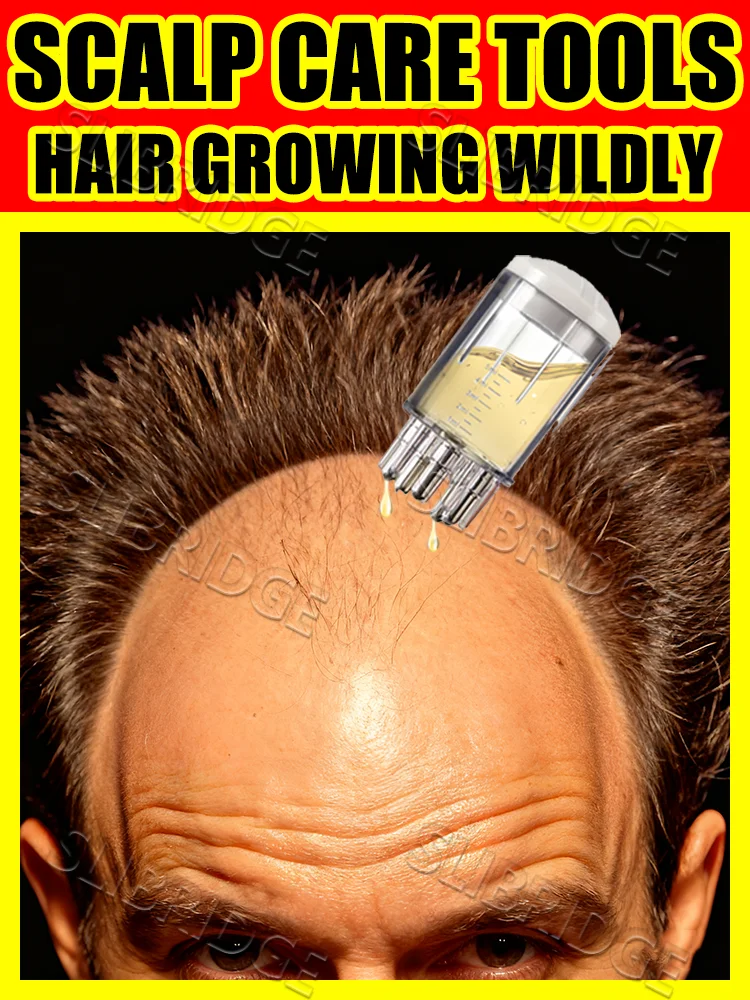 

Аппликатор для кожи головы, фокус на здоровье кожи головы, жидкая расческа, жидкий направляющий массажер, против выпадения волос, инструмент для ухода за кожей головы, бесплатная доставка