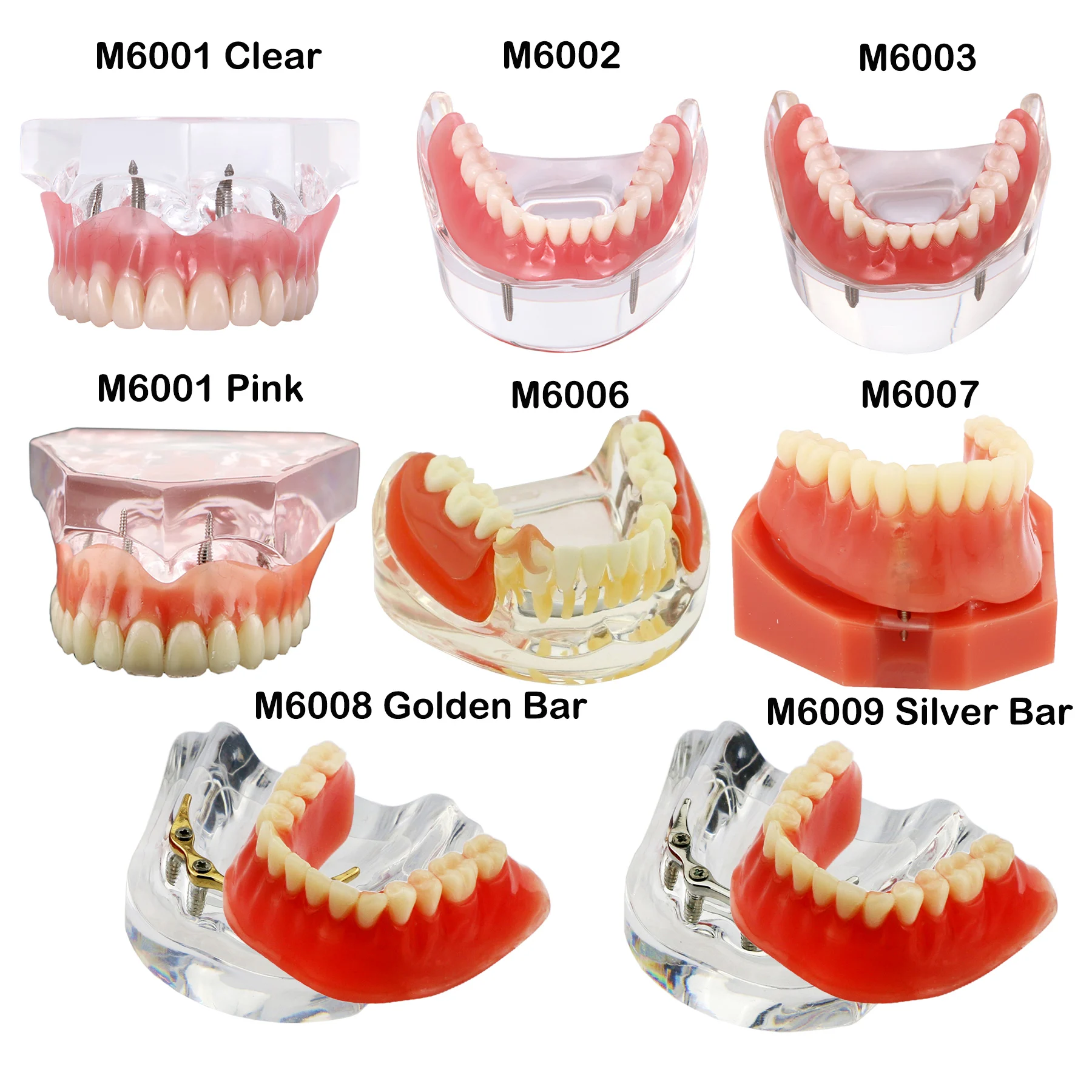 Modelo de dientes dentales, modelo de enseñanza Dental, modelo de implante, modelo de odontología extraíble, para entrenamiento, estudiar, educación