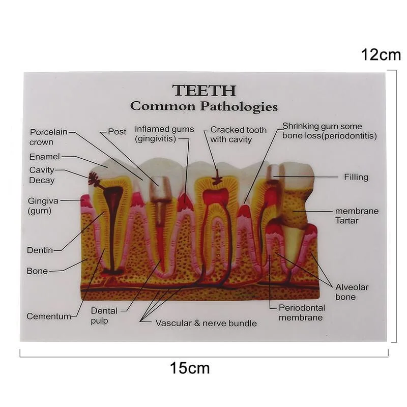 W pełni anatomiczny Model zębów do nauki nauczania demonstracja dentysta modele dentystyczne do edukacji pacjentów produkty stomatologiczne