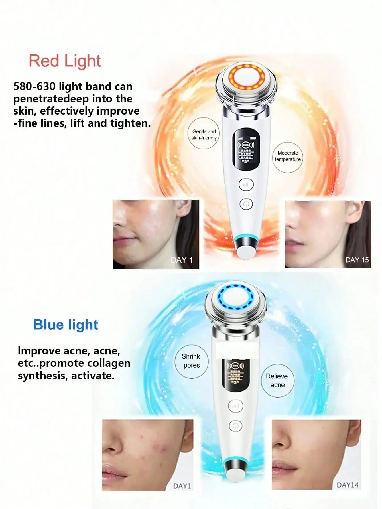 Massaggiatore per il lifting del viso - Macchina per il lifting del viso con microangolo RF Ems per la cura della pelle con fotoni LED per il viso