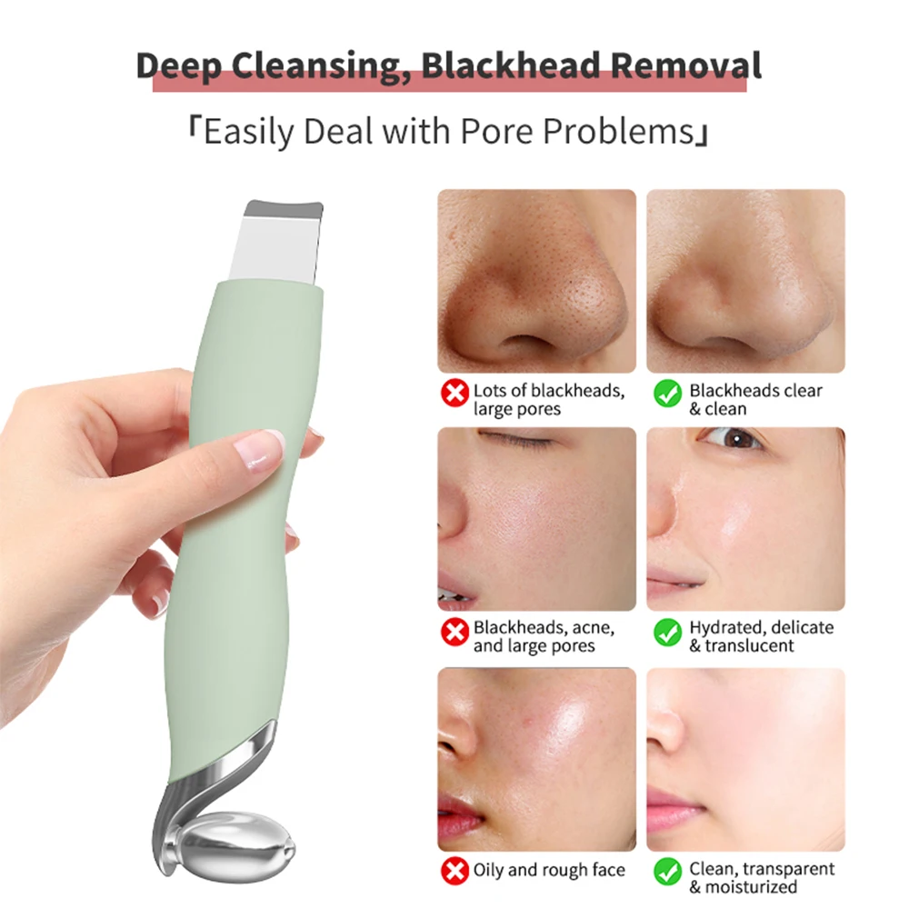 2-in-1 mee-eter verwijderaar gereedschap gezichtsschraper voor poriënreiniging huid scrubber gezicht spatel met koeling ijsroller huidverzorgingstool