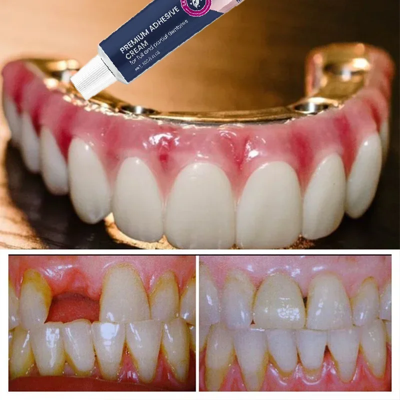Klej do mocowania protez Termoplastyczny klej do protez Wygodne noszenie Zapobieganie rozluźnianiu protez Zdrowie jamy ustnej