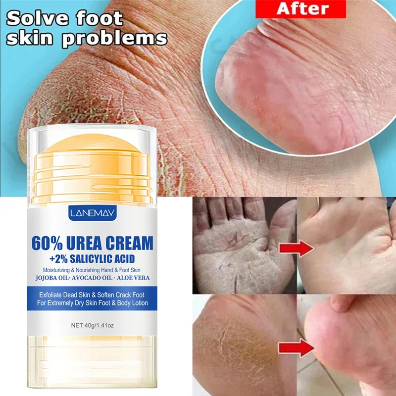 Honey Aloe Vera Foot Cream 40g Ultra-hydrating 60% For Softening Dry Cracked Feet - Gentle Exfoliation Daily Foot Care Solution