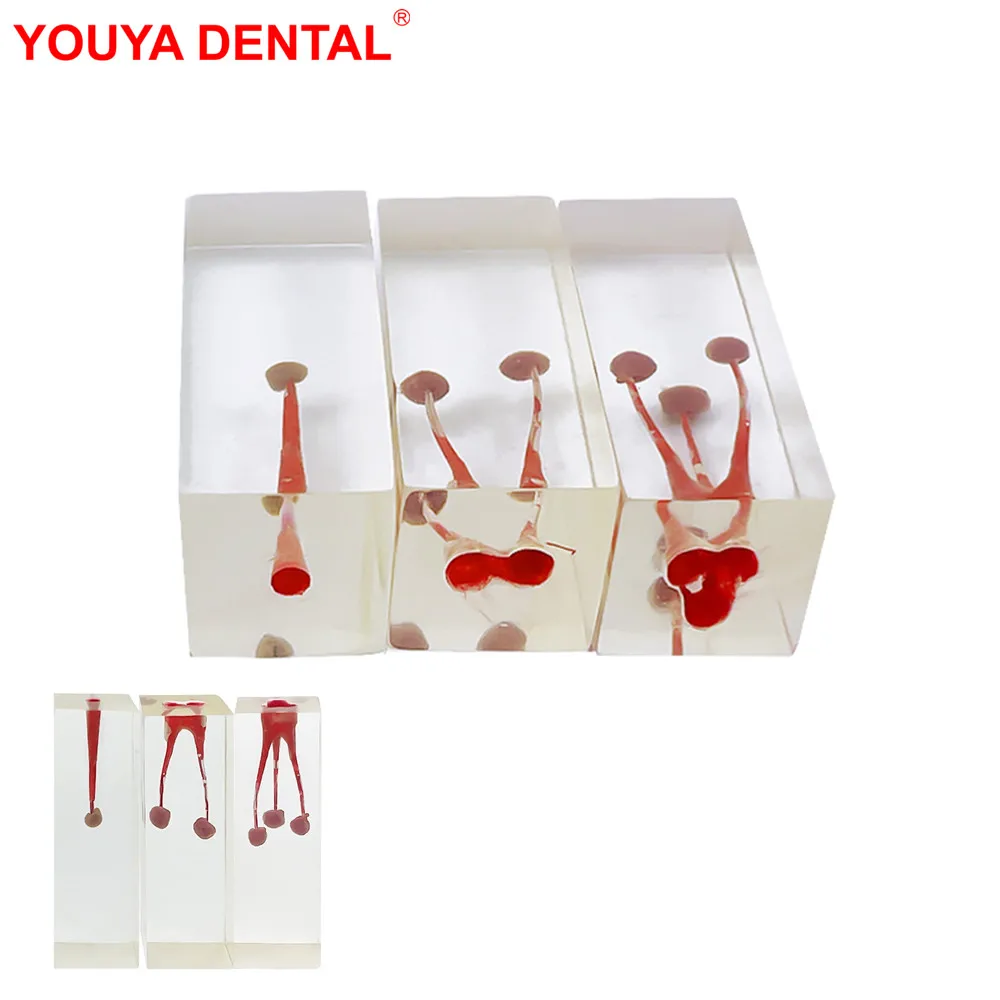 

1pcs Dental Model Endodontic Treatment Training Practice Pulp Cavity RCT Endo Root Canal Block Teeth Model For Teaching Studying