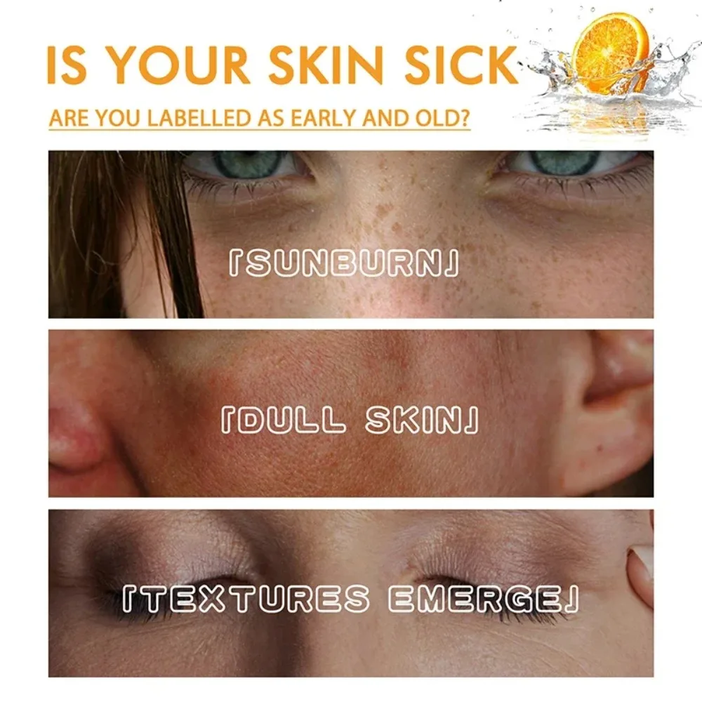 Rimuovere le macchie scure Siero viso sbiancante Lentiggine Dissolvenza Melanina Retinolo Essenza antirughe Schiarente Siero alla vitamina C Pelle