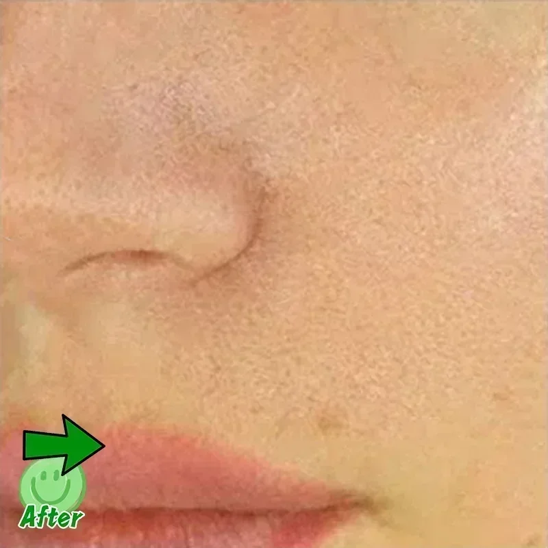 Acid Pore Shrinking Serum Face Removing Large Pores Tightening Repairing Facial Pore Minimizing Essence Oil Firm Skin Care