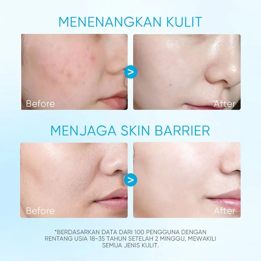 5X Ceramide Barrier Repair Moisture Gel 80g Soothing Moisturizer Skincare Moisturiser Day Night Cream Centella