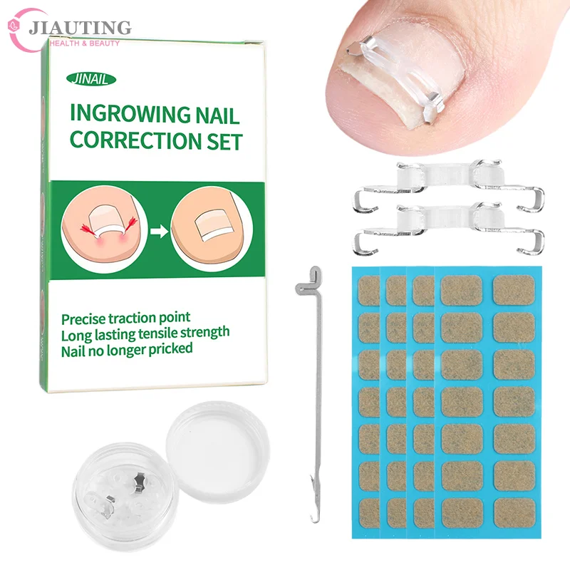1/2Set Stainless Ingrown Toenail Corrector Tools Pedicure Recover Embed Toenail Treatment Professional Foot Care Correction Tool