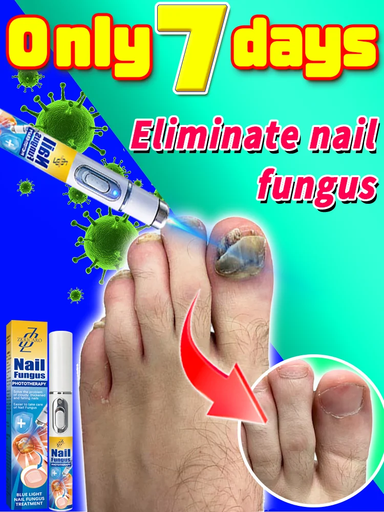 

Tɪɴᴇᴀ Cᴀᴘɪᴛɪs Fᴜɴɢᴀʟ Rᴇᴘᴀɪʀ Nail Fungus Management Tool Toenail Discoloration Repair and Damage Care Tool