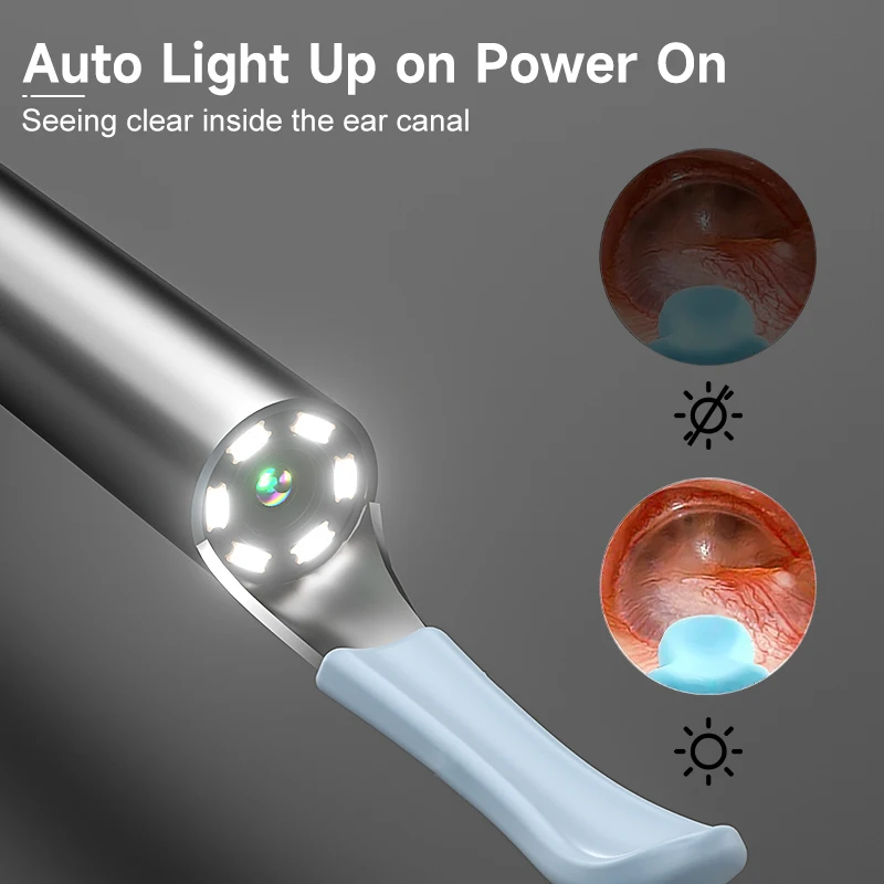 Smart Wireless Ear Cleaner with Gyroscope Stabilization 2.4G HD Ear Camera Auto-Direction Lock 35Min Runtime 130mAh Fast-Charge