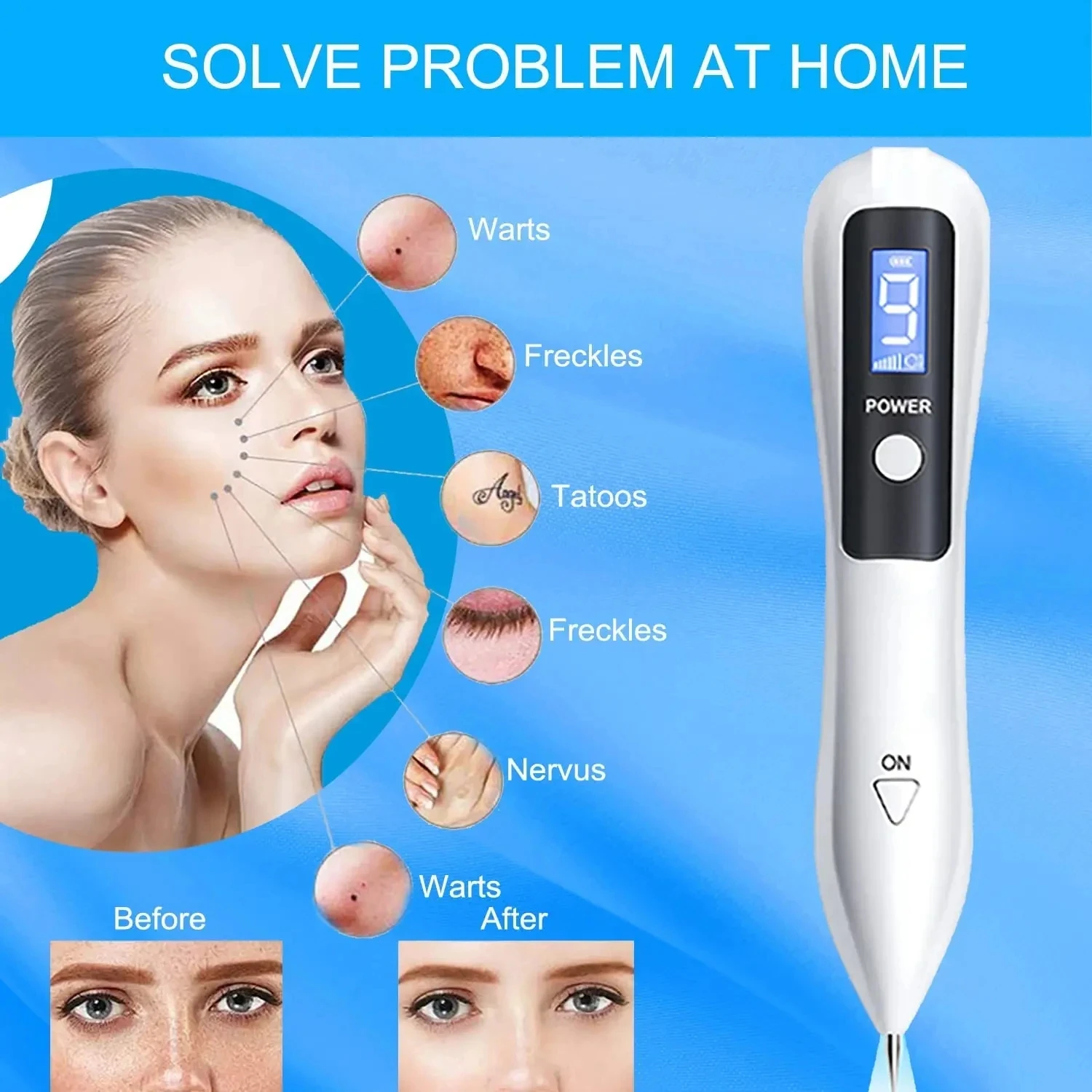 Portable Skin Spot Care Pen Adjustable Level Skin Refining Beauty Tool LED Display Personal Skincare Device