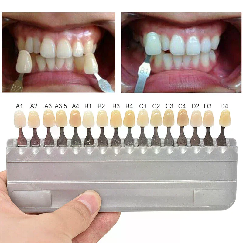 

16-цветные средства для отбеливания зубов, средства для отбеливания зубов, руководство по моделью зуба, колориметрическая пластина, стоматологические цветные весы