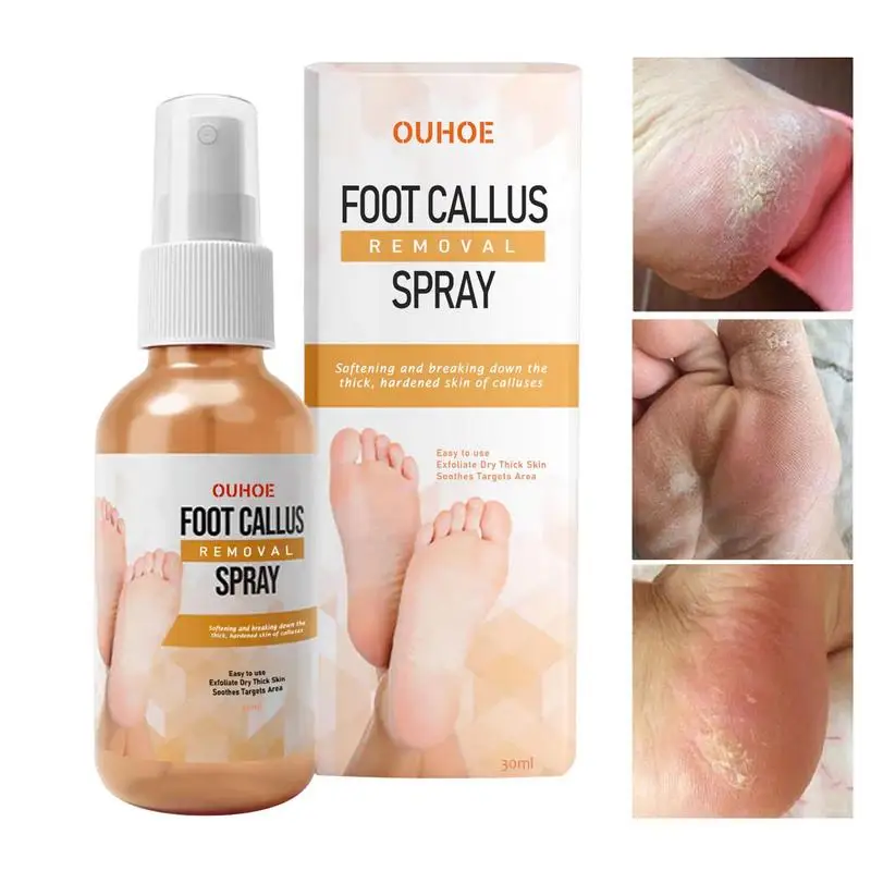 Spray dissolvant de callosités pour les pieds, adoucit rapidement les callosités, exextinction des pieds secs, peau hydratante, fréquence des pieds, soin des pieds, 30ml