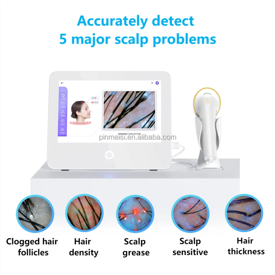 Portable High Quality HD Hair Follicles Scalp Scanner Detector Hair Analyzer