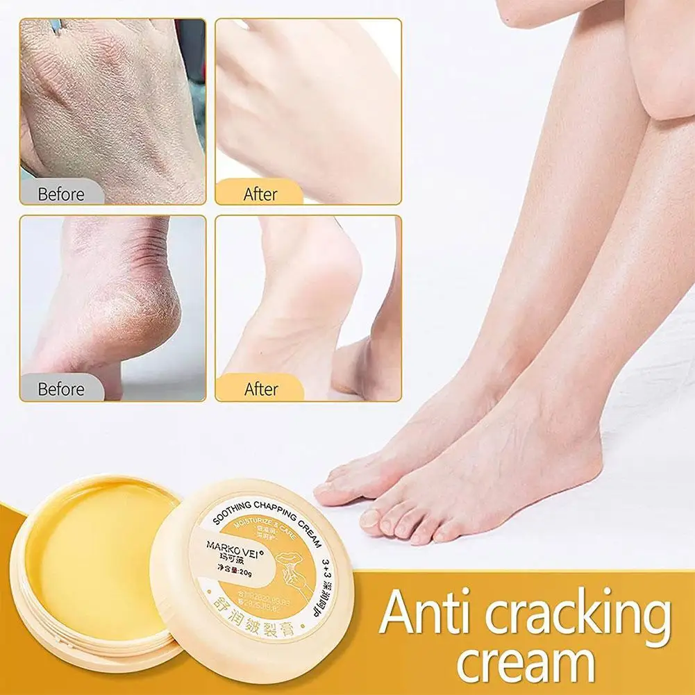 20G Anti Krakende Voet Handcrème Huidherstel Crème Hydraterende Crack Hiel Genezing Zalf Ellebogen Voedende Knieën Vochtinbrengende B4t1