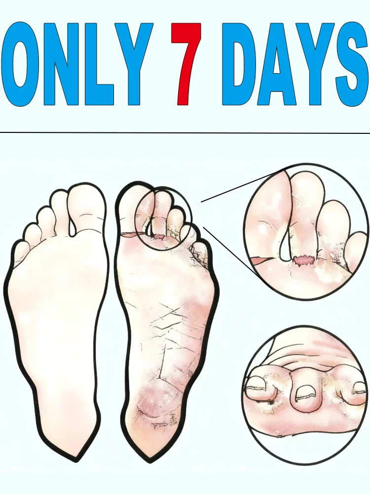 

Aᵗʰˡᵉᵗᵉ'ˢ ᶠᵒᵒᵗ⸴ Sᵐᵉˡˡʸ ᶠᵉᵉᵗ⸴ Tⁱⁿᵉᵃ ᴺᵃⁱˡˢ⸴ Rᵒᵗᵗᵉⁿ ᶠᵉᵉᵗ‧Restore Health