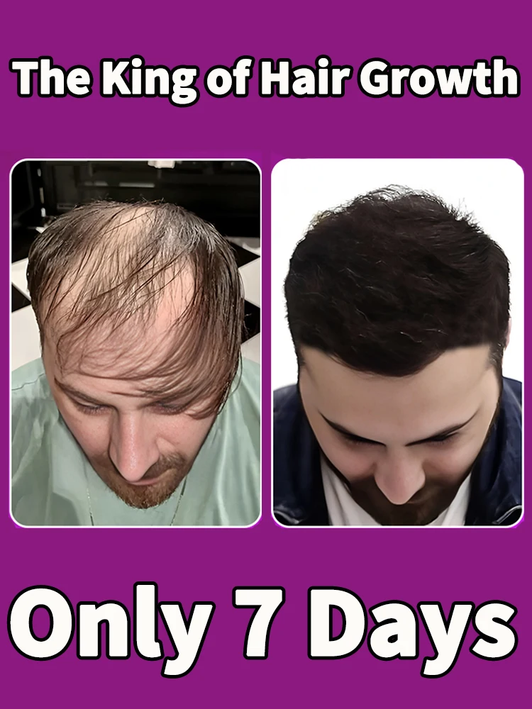 solve hair problems to make your hair thicker and stronger