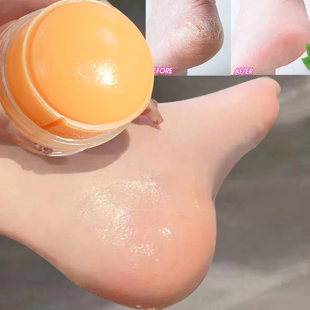 40g Urea Foot Cream Dry Cracked Feet Heel Gentle Exfoliation Softening Skin Ultra-Hydrating Hand Foot Care Cream Stick Protuct