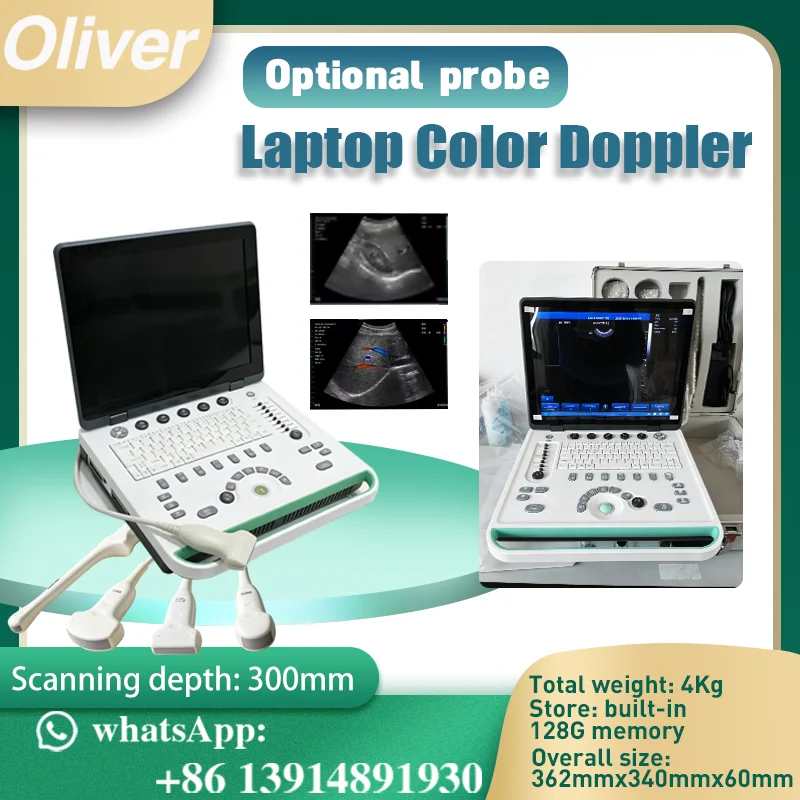 Appareil d'échographie Doppler couleur portable avec écran HD de 15 pouces, équipé de plusieurs sondes, adapté aux soins personnels