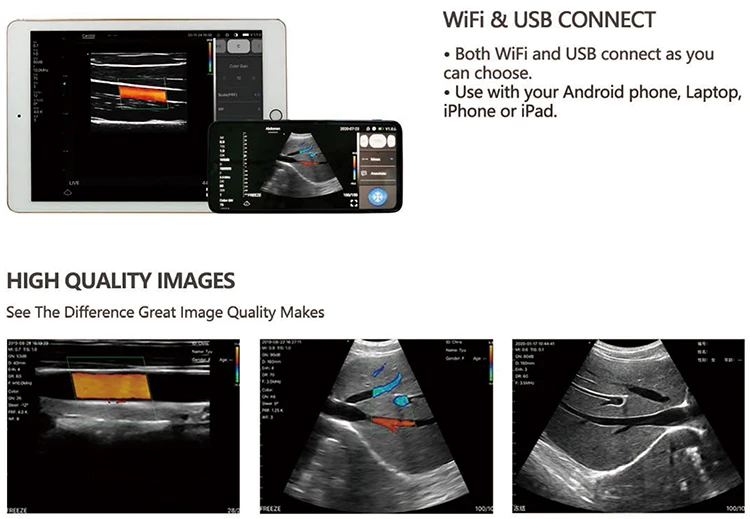 Double Probes cardiology Color Doppler Ultrasound Scanner 3 in 1 cardiac linear convex abdominal wireless android ultrasound