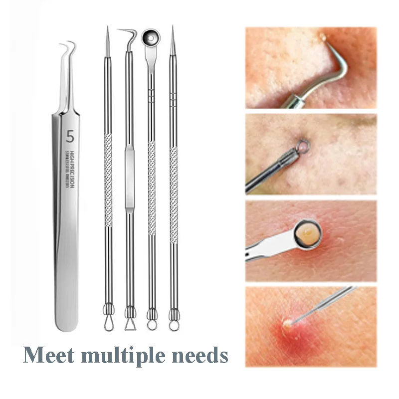 4/5 Stuks Mee-Eter Verwijderaar Comedones Extractor Acne Verwijdering Kit Voor Smet Whitehead Popping Pit Verwijderen Voor Neus Gezicht Gereedschap