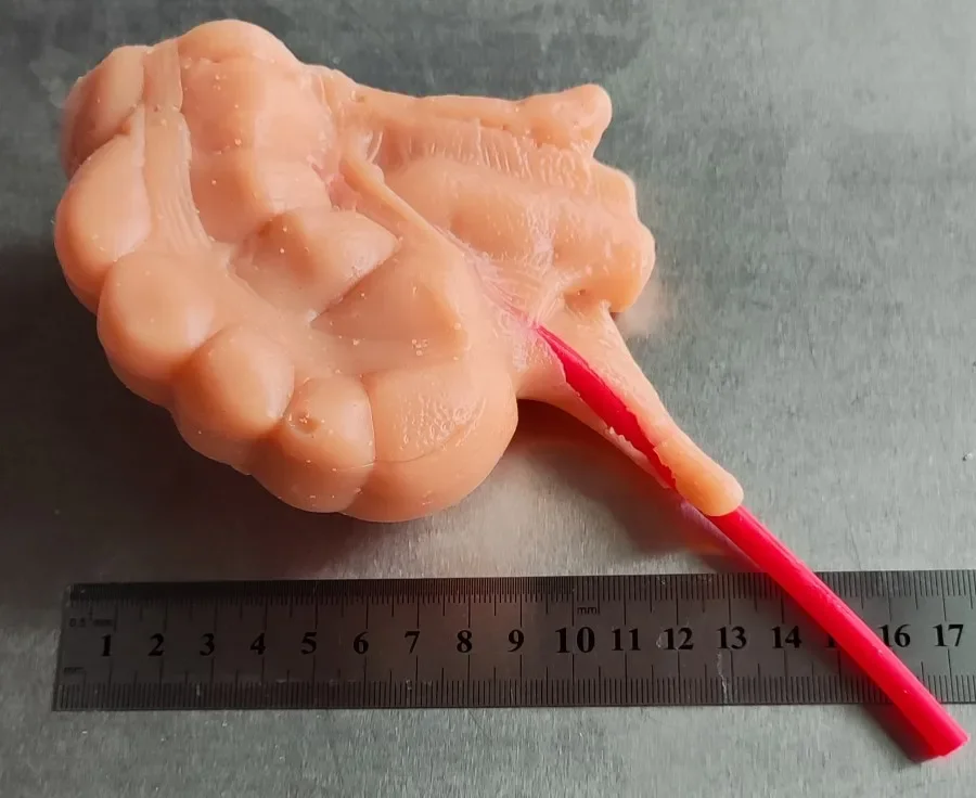 

Surgical Laparoscopic Appendectomy 3D appendix Model for Suture training