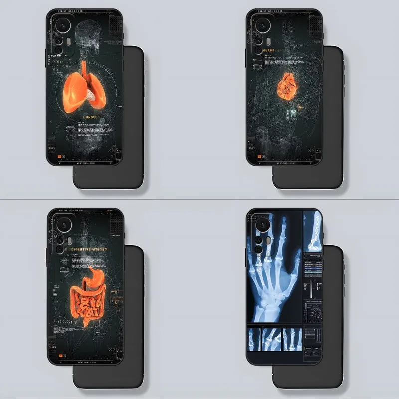 Human Organs Skeleton Skull Phone Case For Xiaomi 13 12 11 9T 11T 9SE 11i Lite Ultra Note10 Poco F3 M4 GT Pro Cover