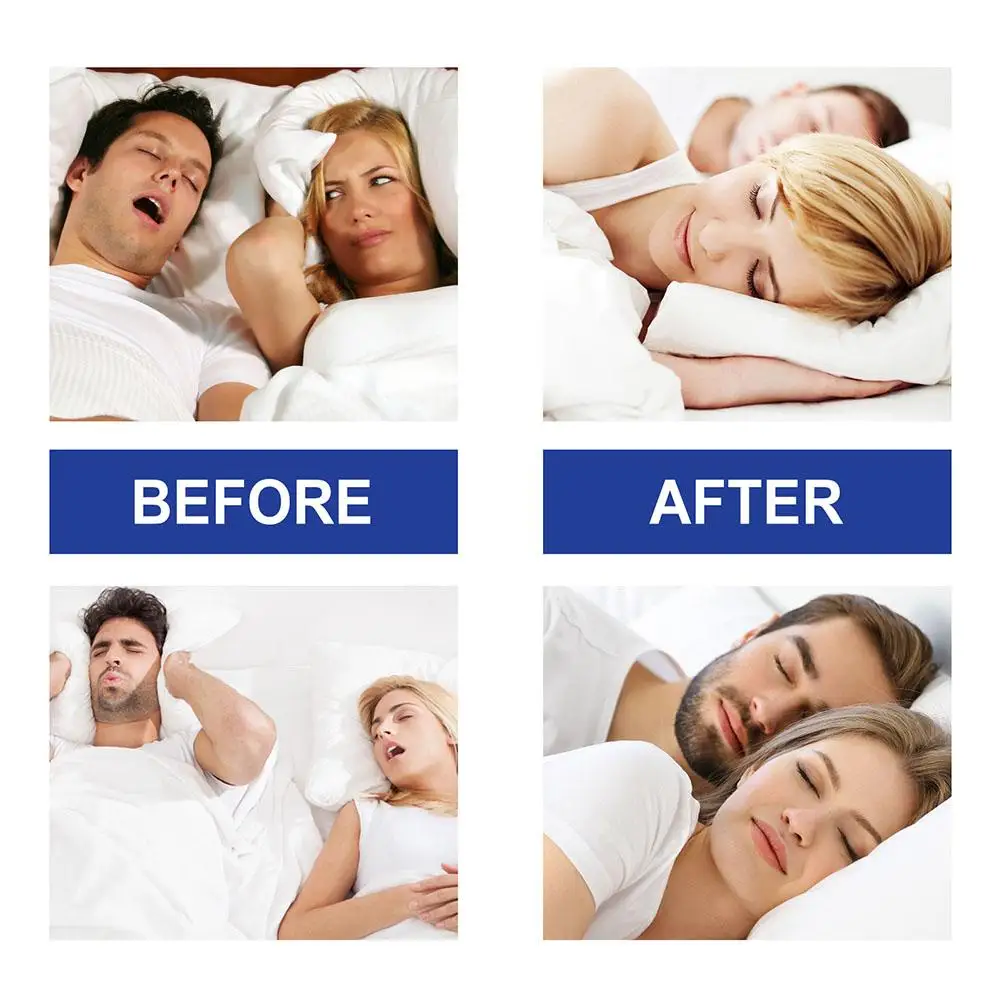 30pcs Anti Snoring Mouth TAPE Nighttime Sleeping ปากการหายใจปรับปรุงลดแห้งปากส่งเสริมจมูกหายใจ Health Care